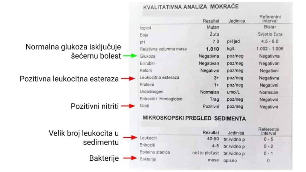 infekcija uzroci noćnog mokrenja